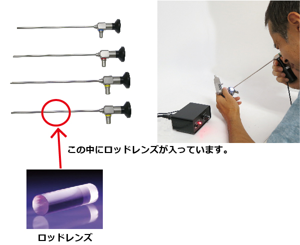 内視鏡スコープ（エンドスコープ）とは？その種類と特徴は